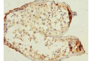 Immunohistochemistry of paraffin-embedded human testis tissue using ABIN7171931 at dilution of 1:100 (TTC32 Antikörper  (AA 1-151))