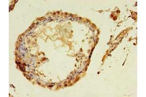 Immunohistochemistry of paraffin-embedded human testis tissue using ABIN7172949 at dilution of 1:100 (TMCO5A Antikörper  (AA 10-192))