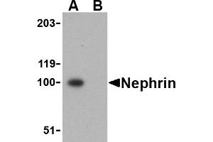 Western blot analysis of Nephrin in mouse kidney tissue lysate with Nephrin antibody at 1 µg/mL in the (A) absence and (B) presence of blocking peptide. (Nephrin Antikörper  (C-Term))