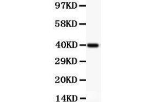 Western Blotting (WB) image for anti-Nuclear Factor of kappa Light Polypeptide Gene Enhancer in B-Cells 1 (NFKB1) (AA 1-360) antibody (ABIN3043587)