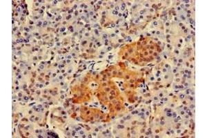 Immunohistochemistry of paraffin-embedded human pancreatic tissue using ABIN7173936 at dilution of 1:100 (TWF1 Antikörper  (AA 199-252))