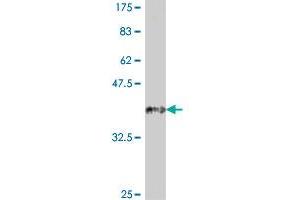 Western Blot detection against Immunogen (37. (SFRP4 Antikörper  (AA 211-312))