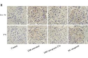 Immunohistochemistry (Paraffin-embedded Sections) (IHC (p)) image for anti-Fibronectin (AA 1201-1300) antibody (ABIN671646)