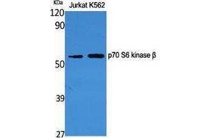 Western Blot (WB) analysis of specific cells using p70 S6 kinase beta Polyclonal Antibody.