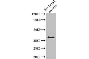 SLC29A1 anticorps  (AA 228-291)