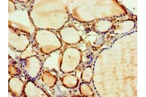 Immunohistochemistry of paraffin-embedded human thyroid tissue using ABIN7169127 at dilution of 1:100 (PAK2 Antikörper  (AA 1-212))