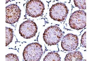 IHC analysis of Symplekin/SYMPK using anti-Symplekin/SYMPK antibody (ABIN7601558). (Symplekin Antikörper  (AA 384-1092))