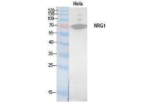 Western Blotting (WB) image for anti-Neuregulin 1 (NRG1) (Internal Region) antibody (ABIN3178546) (Neuregulin 1 Antikörper  (Internal Region))