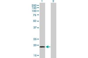 Western Blot analysis of TPPP3 expression in transfected 293T cell line by TPPP3 MaxPab polyclonal antibody.