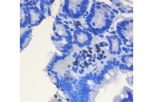 IHC analysis of CD3 epsilon/Cd3e using anti-CD3 epsilon/Cd3e antibody (ABIN7600665). (CD3 epsilon Antikörper  (AA 22-113))
