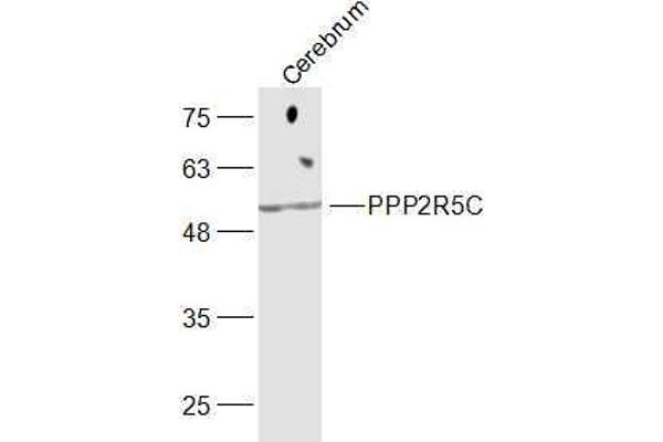 PPP2R5C Antikörper  (AA 390-435)