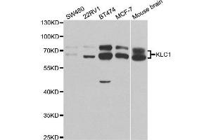 Western Blotting (WB) image for anti-Kinesin Light Chain 1 (KLC1) antibody (ABIN1876732) (KLC1 Antikörper)