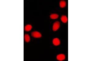 Immunofluorescent analysis of Lamin A/C (pS392) staining in SHSY5Y cells. (Lamin A/C Antikörper  (pSer392))