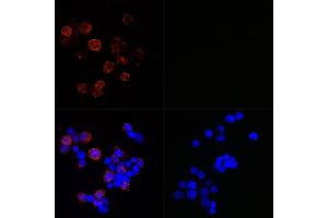 Immunofluorescence analysis of 293T-N and 293T cells using SARS-CoV-2 Nucleoprotein Rabbit mAb (ABIN7269052) at dilution of 1:100,1:400,1:1600,1:3200 (40x lens). (Nucleoprotein Antikörper)
