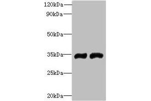 Western blot All lanes: FYTTD1 antibody at 4 μg/mL Lane 1: A375 whole cell lysate Lane 2: Jurkat whole cell lysate Secondary Goat polyclonal to rabbit IgG at 1/10000 dilution Predicted band size: 36, 34, 29, 15 kDa Observed band size: 36 kDa (FYTTD1 Antikörper  (AA 1-318))