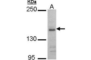 Western Blotting (WB) image for anti-Glutamate Receptor, Ionotropic, N-Methyl D-Aspartate 2B (GRIN2B) (AA 1010-1259) antibody (ABIN467519) (GRIN2B Antikörper  (AA 1010-1259))
