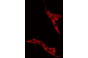 ABIN6275488 staining A549 cells by IF/ICC. (ARHGDIG Antikörper  (Internal Region))