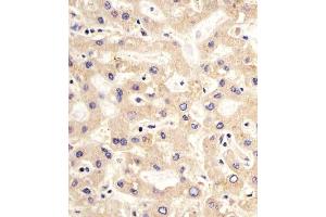 (ABIN659060 and ABIN2838063) staining PDK2 in human liver sections by Immunohistochemistry (IHC-P - paraformaldehyde-fixed, paraffin-embedded sections). (PDK2 Antikörper)