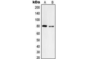 Western blot analysis of Tyrosinase expression in A375 (A), HepG2 (B) whole cell lysates. (TYR Antikörper  (C-Term))