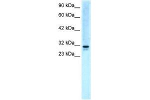 Western Blot showing EAP30 antibody used at a concentration of 5. (SNF8 Antikörper  (N-Term))