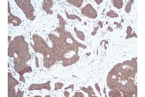 Image no. 3 for anti-Chemokine (C-X-C Motif) Ligand 10 (CXCL10) antibody (ABIN465012) (CXCL10 Antikörper)
