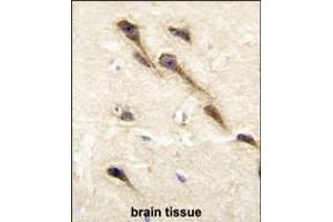 Formalin-fixed and paraffin-embedded human brain tissue reacted with CYP26B1 antibody (C-term), which was peroxidase-conjugated to the secondary antibody, followed by DAB staining.