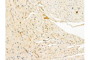 Phospho-BCKDHA (Ser292/Ser337) Antibody at 1/100 staining Mouse heart tissue by IHC-P.