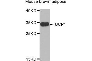 Western blot analysis of extracts of mouse brown adipose, using UCP1 antibody (ABIN5974361). (UCP1 Antikörper)