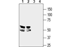 Western blot analysis of mouse brain (lanes 1 and 3) and rat hippocampus (lanes 2 and 4) lysates: - 1,2. (LRRTM1 Antikörper  (Extracellular, N-Term))