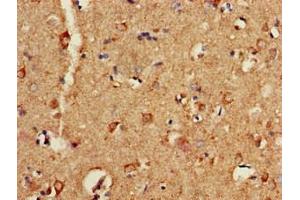Immunohistochemistry of paraffin-embedded human brain tissue using ABIN7162439 at dilution of 1:100