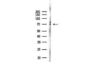 anti-Complement Component C9 (C9) antibody
