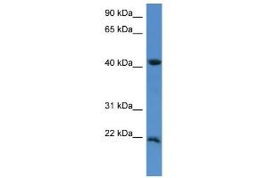 WB Suggested Anti-IMMP2L Antibody Titration: 0. (IMMP2L Antikörper  (C-Term))