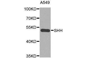 Western blot analysis of extracts of A-549 cells, using SHH antibody. (Sonic Hedgehog Antikörper)