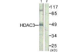 Immunohistochemistry analysis of paraffin-embedded human skin tissue, using HDAC3 (Ab-424) antibody. (HDAC3 Antikörper)