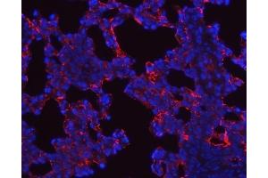 anti-Surfactant Associated Protein A2 (SFTPA2) (AA 206-237), (C-Term) antibody