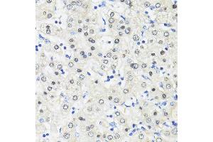 Immunohistochemistry of paraffin-embedded Human liver using TRIM27 antibody (ABIN7269922) at dilution of 1:100 (40x lens). (TRIM27 Antikörper  (AA 1-200))