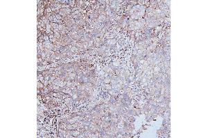 IHC analysis of DDR1 using anti-DDR1 antibody (ABIN7601407). (DDR1 Antikörper  (AA 341-909))
