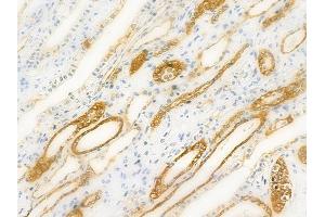 ABIN6257684 and ABIN6274920 at 1/100 staining human normal kidney tissue by IHC-P.