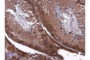 Immunohistochemistry (IHC) image for anti-Tight Junction Protein 1 (TJP1) (N-Term) antibody (ABIN2856624)