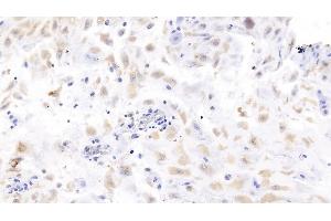 Detection of LHb in Human Placenta Tissue using Monoclonal Antibody to Luteinizing Hormone Beta Polypeptide (LHb) (LHB Antikörper  (AA 21-141))