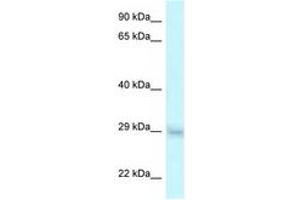 Image no. 1 for anti-Steroid Receptor RNA Activator 1 (SRA1) (AA 92-141) antibody (ABIN6747630)