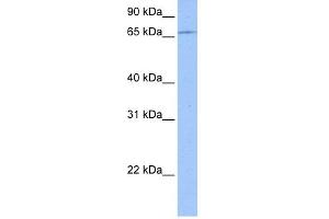 WB Suggested Anti-ZNF317 Antibody Titration:  0. (ZNF317 Antikörper  (C-Term))