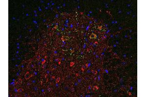 Indirect immunofluorescence labeling of PFA fixed, paraffin embedded mouse spinal cord section with anti-SV 31 (dilution 1 : 500; red) and guinea pig anti-VAchT (, dilution 1 : 500, green). (TMEM163 Antikörper  (AA 44-63))