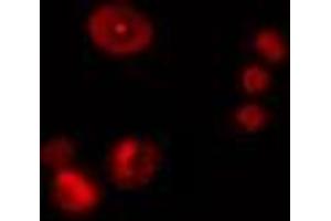 ABIN6274476 staining Hela cells by IF/ICC. (ZNF668 Antikörper  (Internal Region))