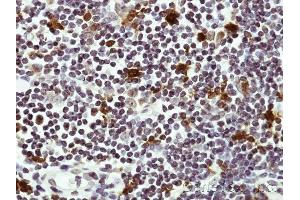 Immunohistochemical staining of paraffin-embedded Human lymph tissue using HICE1 antibody at a dilution of 1:50 (NYS48/HAUS8 Antikörper)