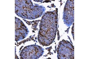 IHC analysis of LIN41/TRIM71 using anti-LIN41/TRIM71 antibody (ABIN7602565).