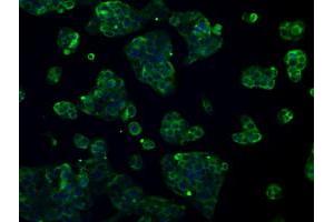 Image no. 6 for anti-L1 Cell Adhesion Molecule (L1CAM) antibody (ABIN1499088)