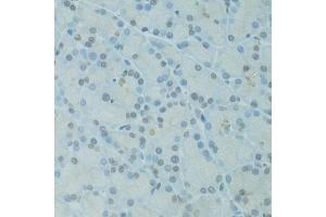 Immunohistochemistry of paraffin-embedded rat pancreas using GTF2H2C antibody  at dilution of 1:100 (40x lens). (GTF2H2C Antikörper  (AA 1-300))