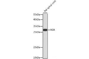 Western blot analysis of extracts of Rat spinal cord using RGR Polyclonal Antibody at dilution of 1:1000. (RGR Antikörper)