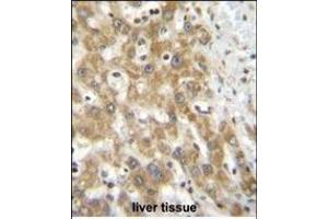 NPS3A Antibody (Center) (ABIN655107 and ABIN2844739) immunohistochemistry analysis in formalin fixed and paraffin embedded human liver tissue followed by peroxidase conjugation of the secondary antibody and DAB staining. (NIPSNAP3A Antikörper  (AA 74-102))